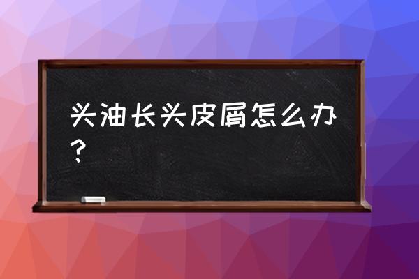头屑多头发油怎麽办 头油长头皮屑怎么办? 头屑多头发油怎麽办 头油长头皮屑怎么办?